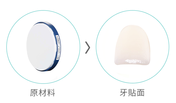 Cercon 牙貼面