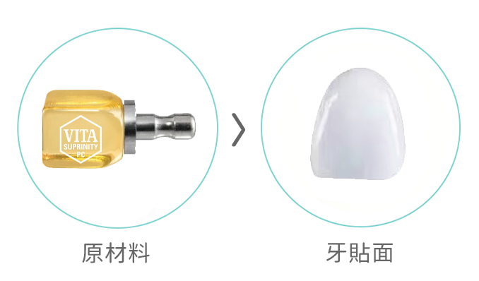 VITA 牙貼面