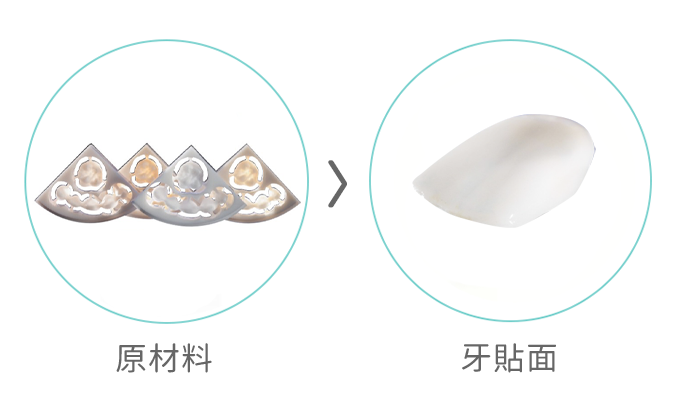 WIELAND 牙貼面