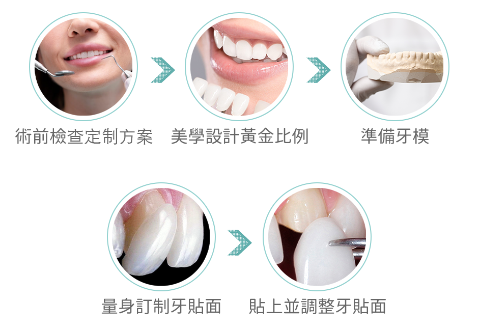  牙貼面 制作過程