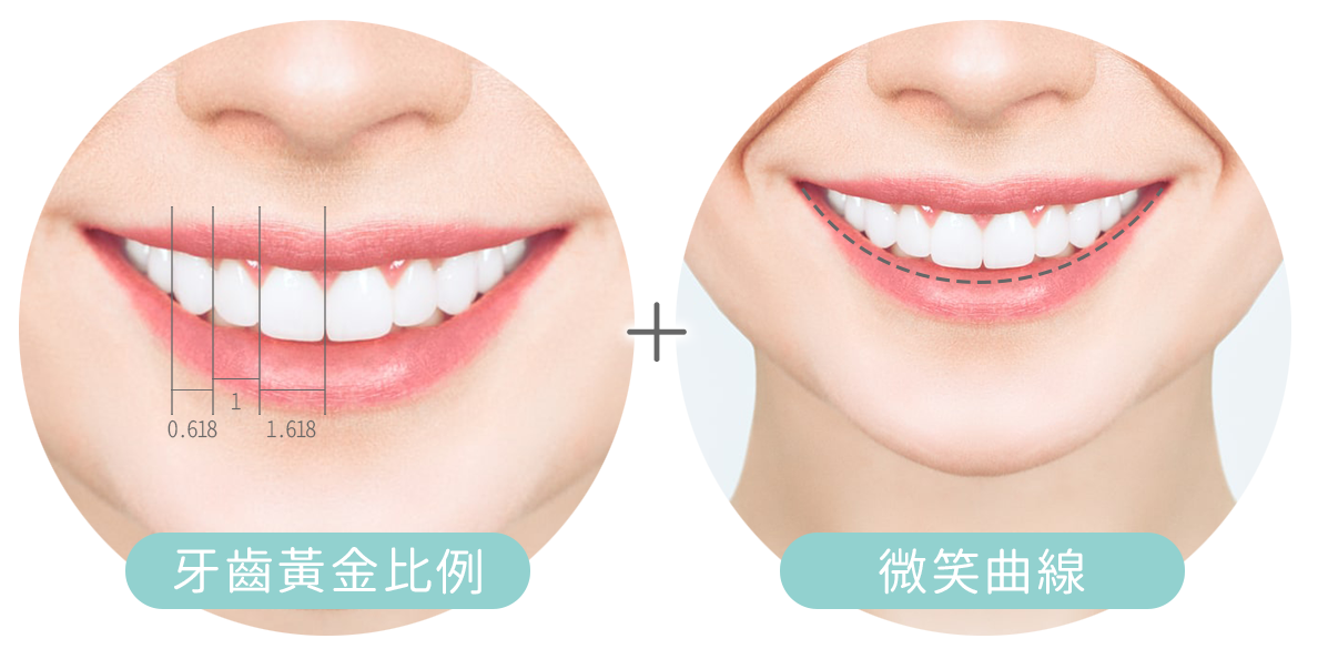 牙齒微笑線設計