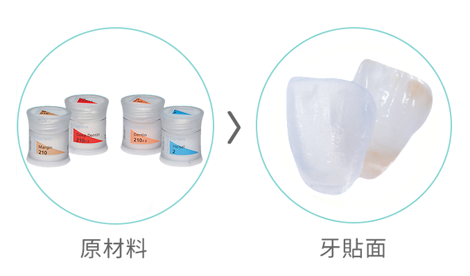 手工瓷 牙貼面