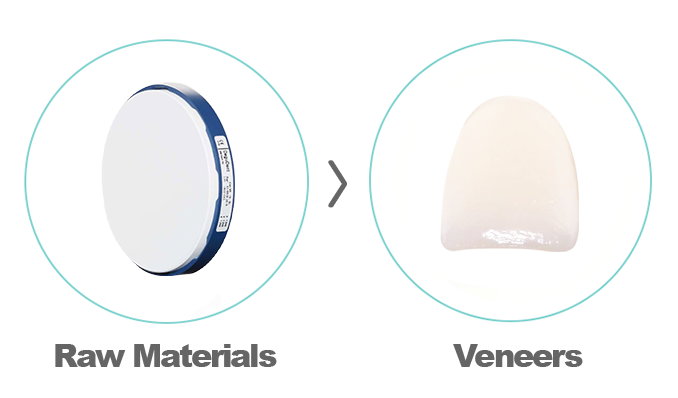 Porcelain Veneer