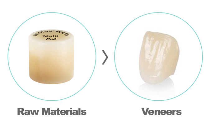 Emax veneer
