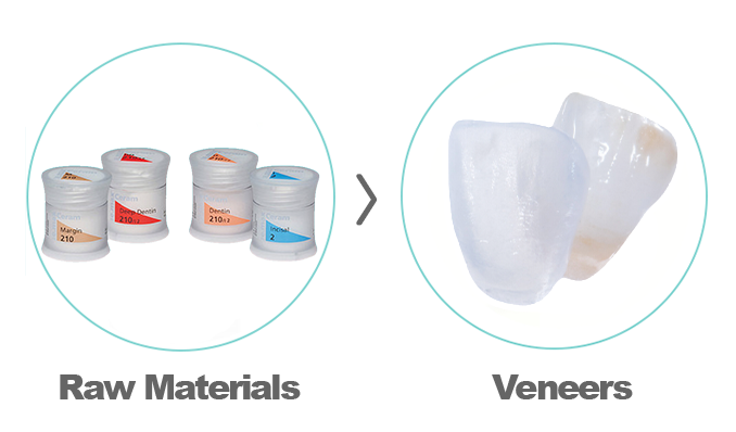 Dental Veneers Hong Kong