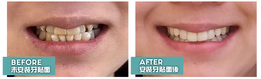 馬小姐 BF